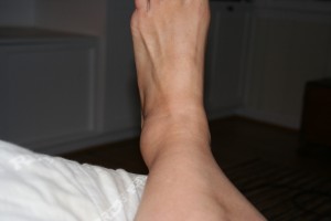 Big Ass Ankle